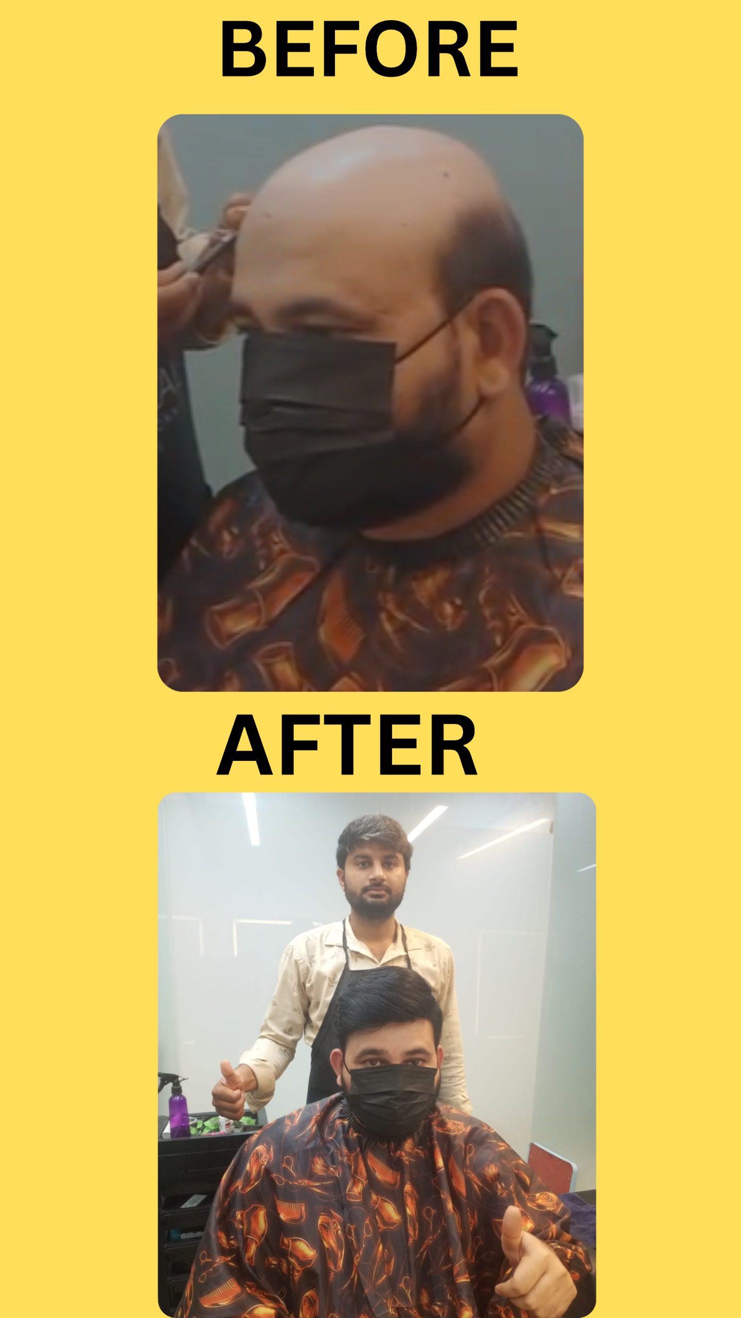 Non surgical hair replacement hyd