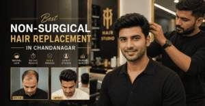 Best NonSurgical Hair Replacement in Chandanagar | Natural Look & Instant Results
